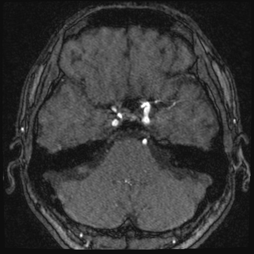 Click on the Serie image to view the images of VILLANUEVA, WILLIAM A.